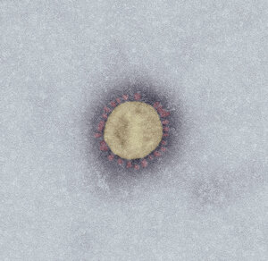 SARS-Coronavirus-2 (SARS-CoV-2, Isolat SARS-CoV-2/Italy-INMI1). Elektronenmikroskopie, Negativkontrastierung (PTA). Maßstab: 100 nm.